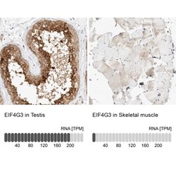 eIF4GII Antibody, Novus Biologicals 25 &mu;L; Unlabeled:Antibodies, Polyclonal